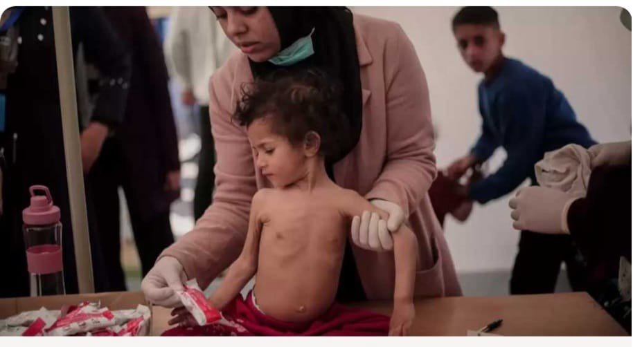 تقرير بالصور: أطفال غزّة حياتهم جوع وخوف وحرمان ونهايتهم الحرق والتقطيع