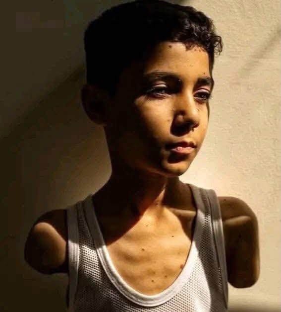 تقرير بالصور: أطفال غزّة حياتهم جوع وخوف وحرمان ونهايتهم الحرق والتقطيع