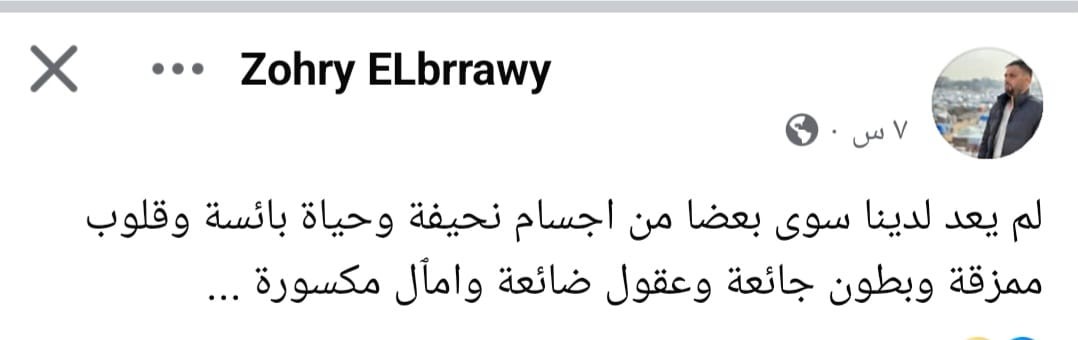 تقرير خاص: غزّة تطرق أبواب المجاعة وتفتحه على مصراعيه وكارثة غير مسبوقة تُدمر ما بقي منها