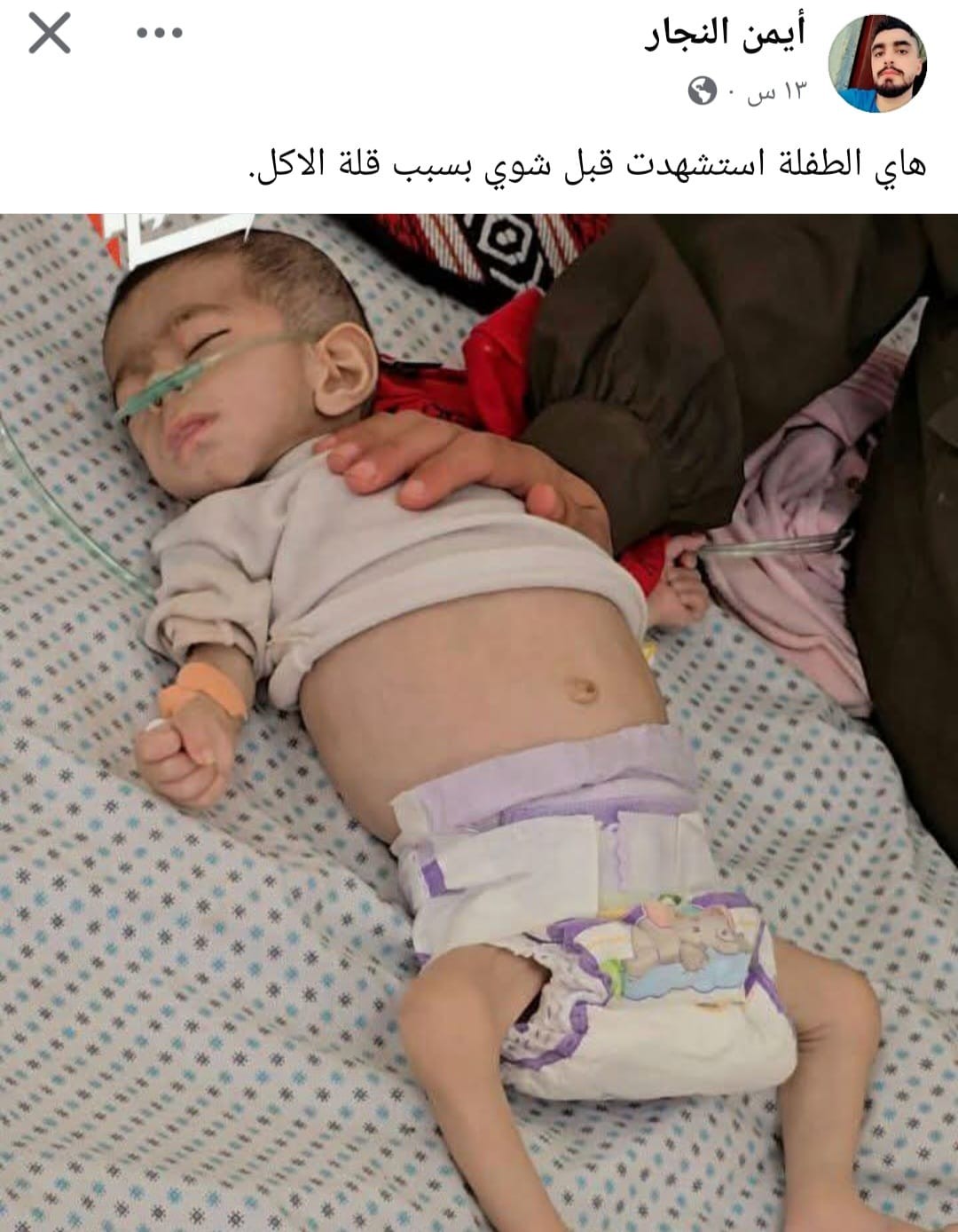 تقرير خاص: غزّة تطرق أبواب المجاعة وتفتحه على مصراعيه وكارثة غير مسبوقة تُدمر ما بقي منها