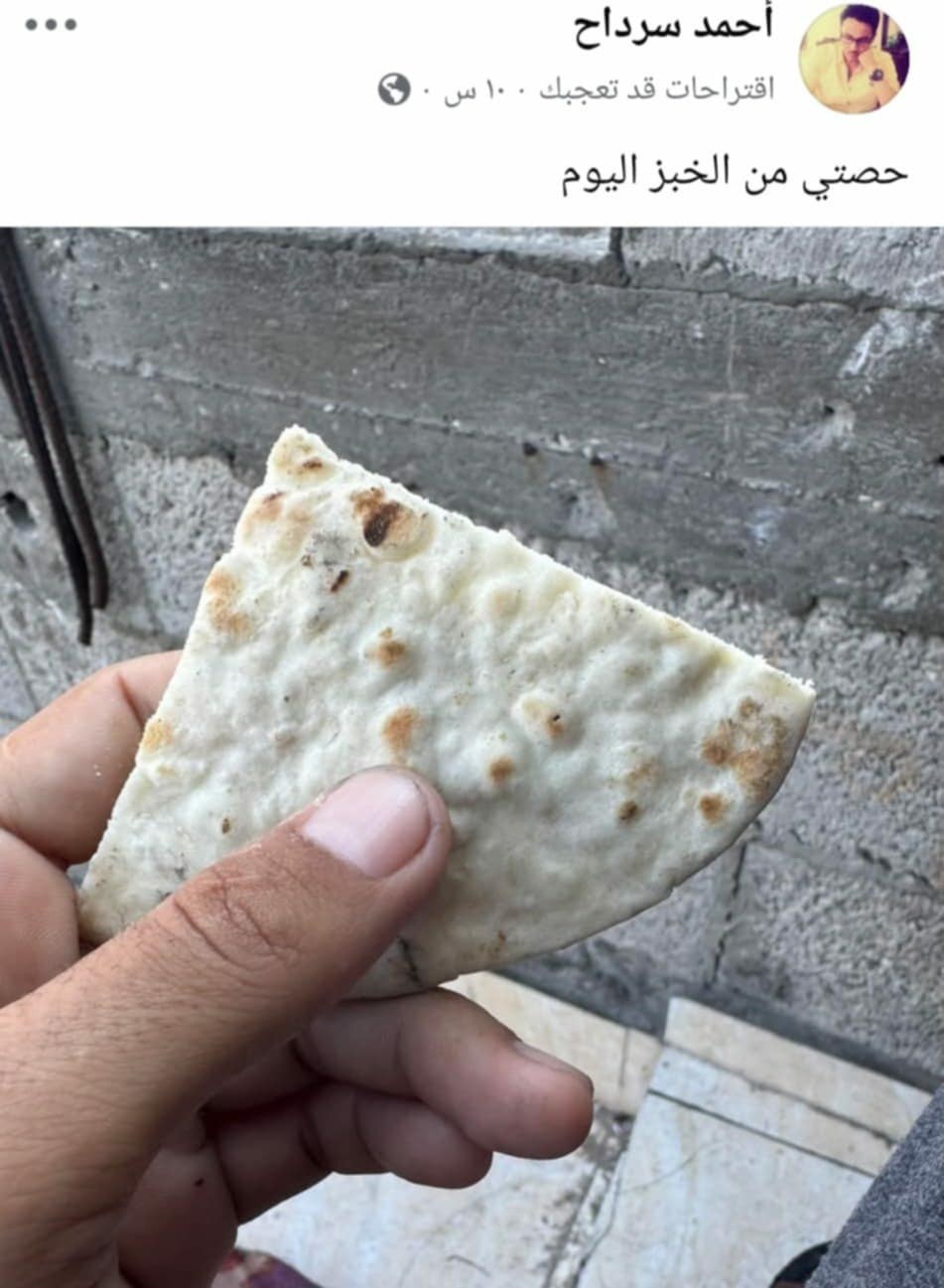 تقرير: غزة.. بطون خاوية وأجساد هزيلة تبحث عن الطعام واحتلال لا يستثني أحد