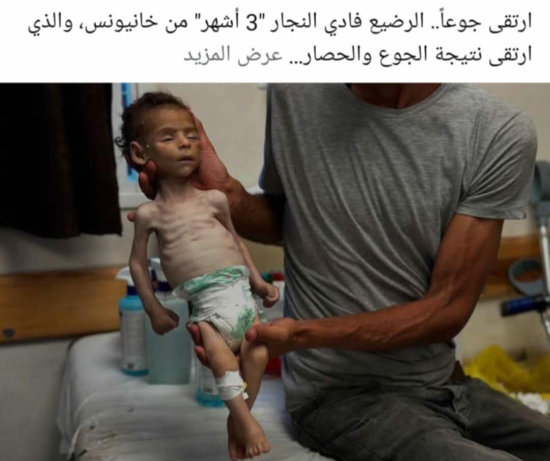 تقرير: غزة.. بطون خاوية وأجساد هزيلة تبحث عن الطعام واحتلال لا يستثني أحد