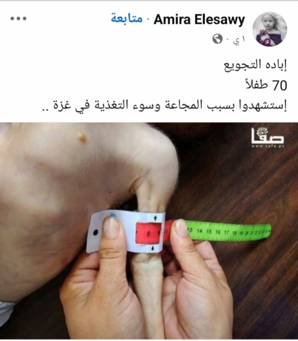 تقرير: غزة.. بطون خاوية وأجساد هزيلة تبحث عن الطعام واحتلال لا يستثني أحد