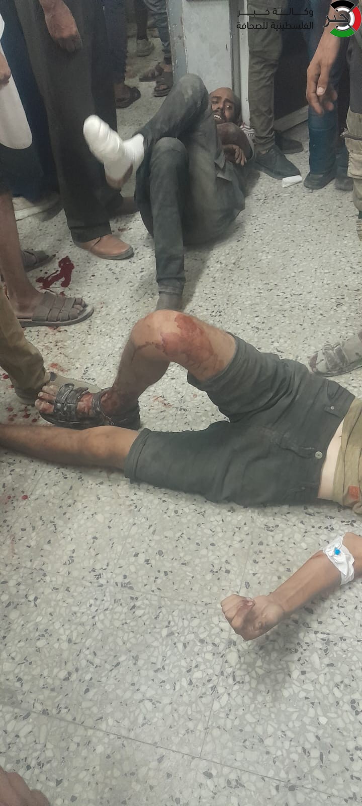 شاهد: مستشفيات غزة تُعاني نقصاً حاداً في الأسِرة والأطباء يفاضلون بين الجرحى لإنقاذ حياتهم