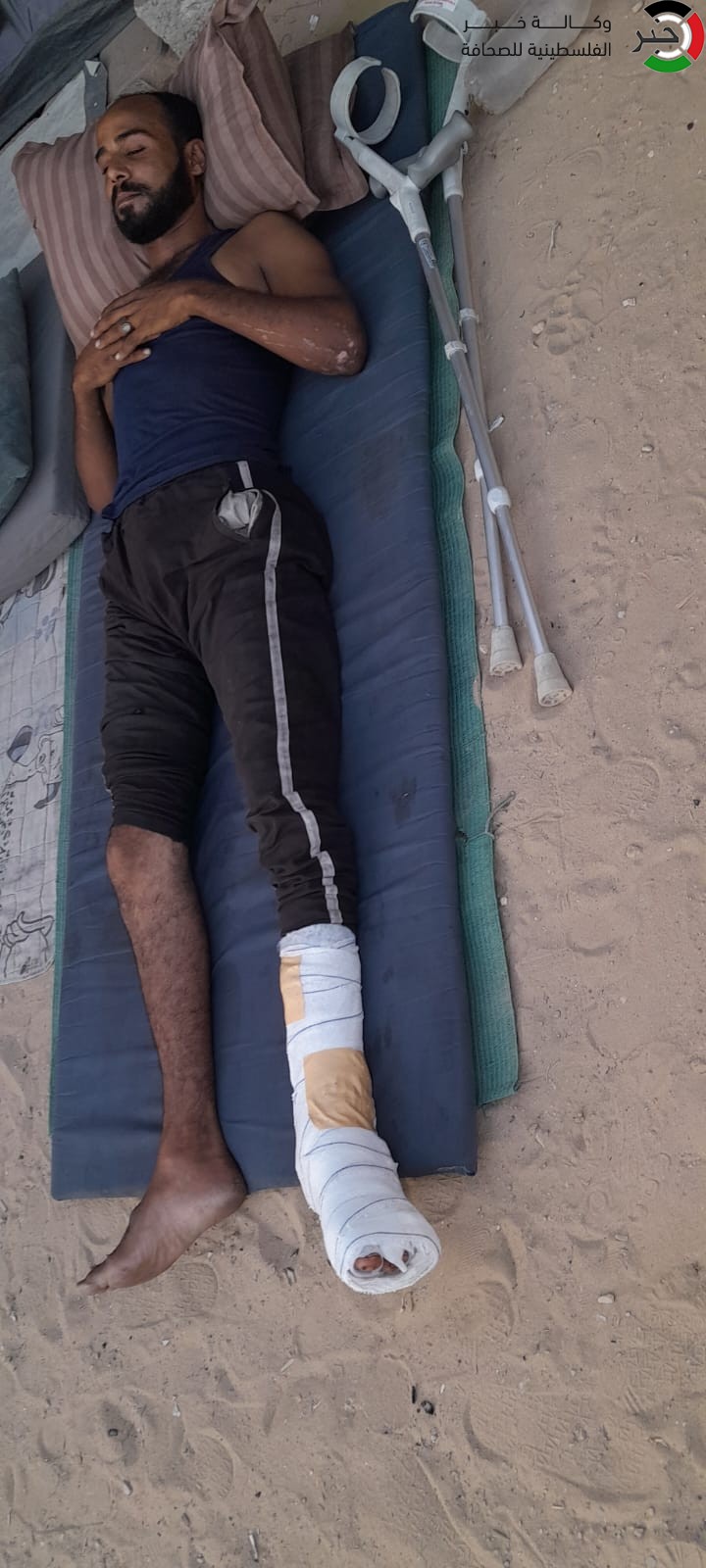 شاهد: مستشفيات غزة تُعاني نقصاً حاداً في الأسِرة والأطباء يفاضلون بين الجرحى لإنقاذ حياتهم