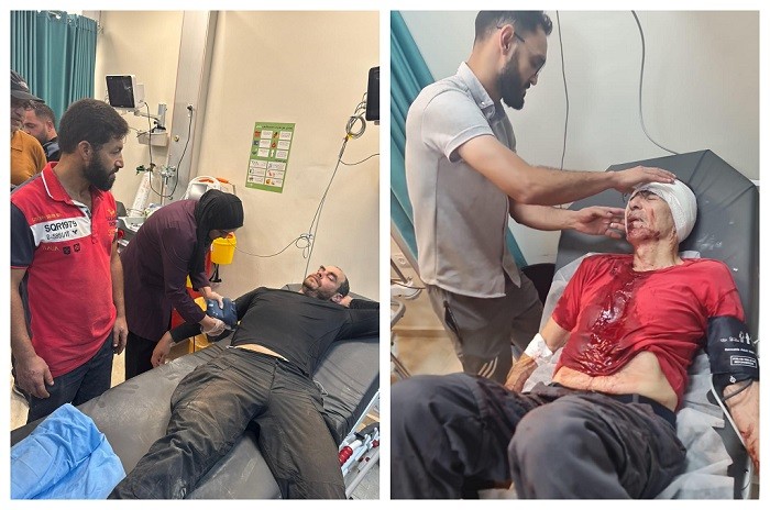 بالصور: إصابة مسعفين وصحفيين في اعتداء للمستعمرين في بلدة بيتا